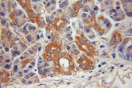 [51054-2-AP-20UL] Jph2 Polyclonal antibody