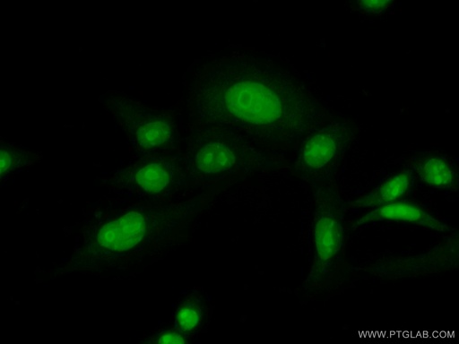 [51062-1-AP-20UL] PHF6 Polyclonal antibody