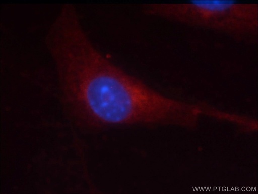 [51065-1-AP-20UL] GSK3B Polyclonal antibody