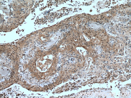 [51066-1-AP-150UL] IkB Alpha Polyclonal antibody