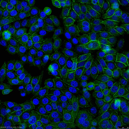 [51067-2-AP-150UL] Beta Catenin Polyclonal antibody