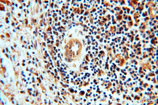 [51073-1-AP-150UL] STAT6 Polyclonal antibody