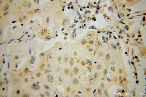 [51074-2-AP-20UL] STAT5A Polyclonal antibody
