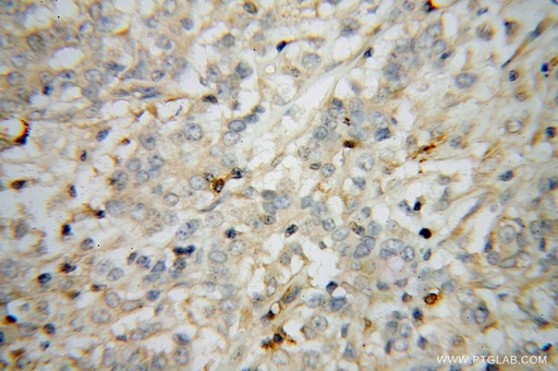 [51075-2-AP-20UL] STAT2 Polyclonal antibody