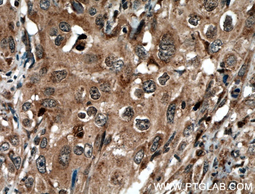[51076-2-AP-150UL] STAT3 Polyclonal antibody