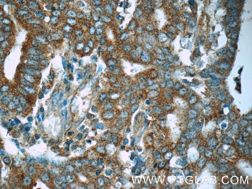 [51080-1-AP-20UL] MEK1-Specific Polyclonal antibody