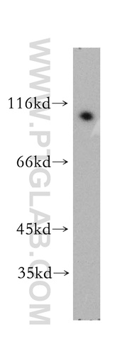 [51085-1-AP-20UL] NFKB2 Polyclonal antibody