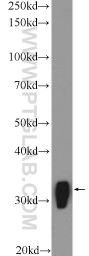 [51087-1-AP-20UL] MARCKS Polyclonal antibody