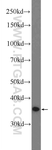 [51094-1-AP-150UL] MEK6 Polyclonal antibody