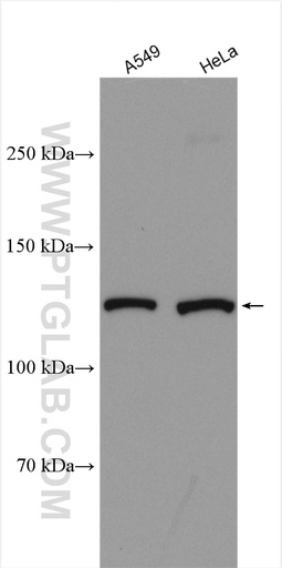 [51101-1-AP-20UL] KIAA1033 Polyclonal antibody