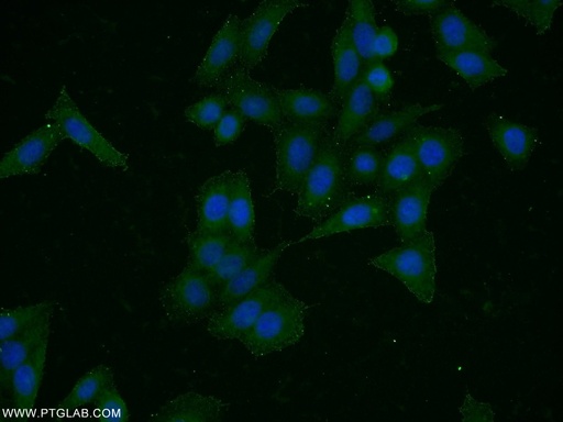[51105-1-AP-20UL] HER2/ErbB2 Polyclonal antibody