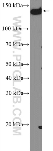 [51139-1-AP-150UL] PLCB3 Polyclonal antibody