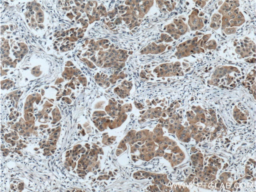 [51141-1-AP-150UL] PPP1R13L Polyclonal antibody