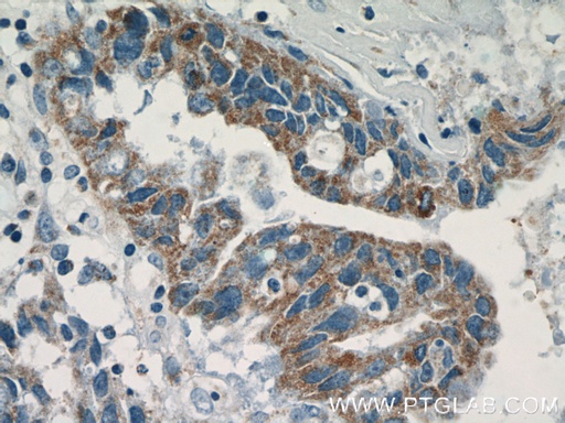 [51142-1-AP-20UL] MEK4 Polyclonal antibody