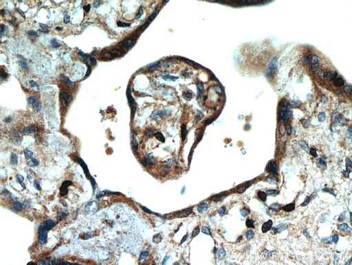 [51144-1-AP-150UL] SMAD4 Polyclonal antibody