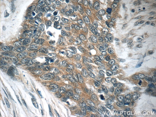 [51149-1-AP-20UL] TMPRSS3 Polyclonal antibody