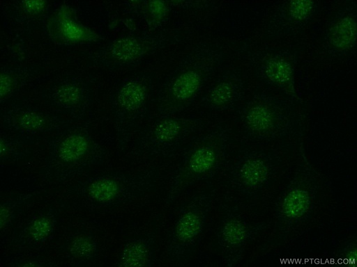 [51151-1-AP-20UL] JNK Polyclonal antibody