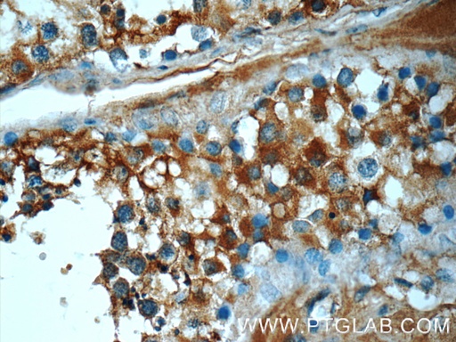 [51152-1-AP-20UL] ATP6V1A Polyclonal antibody