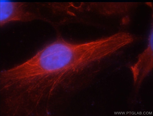 [51153-1-AP-150UL] JNK2 Polyclonal antibody