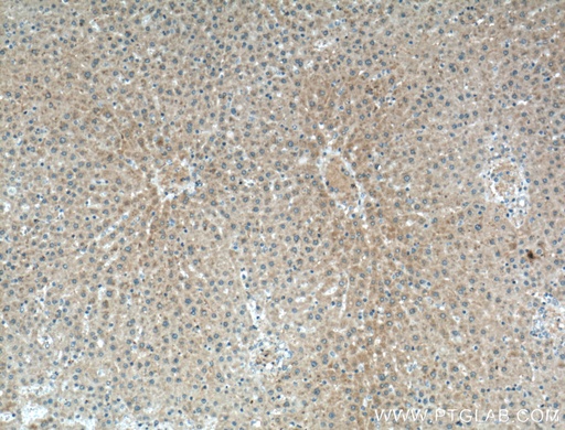 [51157-1-AP-20UL] Cyp4a12a Polyclonal antibody