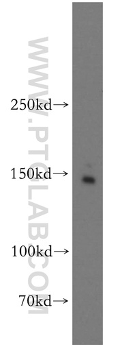 [55001-1-AP-150UL] Drosha Polyclonal antibody