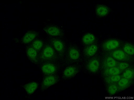 [55005-1-AP-20UL] SETD1B Polyclonal antibody