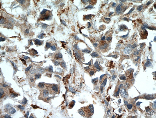 [55009-1-AP-150UL] WDFY3 Polyclonal antibody