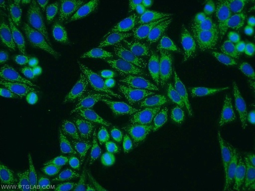 [55011-1-AP-150UL] HTRA1 Polyclonal antibody