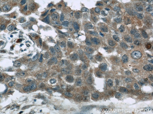 [55021-1-AP-20UL] Cathepsin D Polyclonal antibody