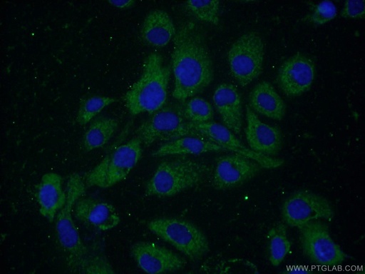 [55023-1-AP-150UL] ELOVL4 Polyclonal antibody