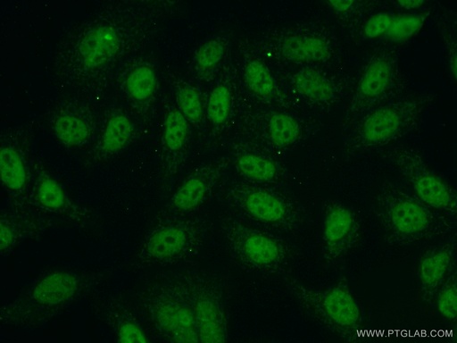[55025-1-AP-150UL] NBS1 Polyclonal antibody