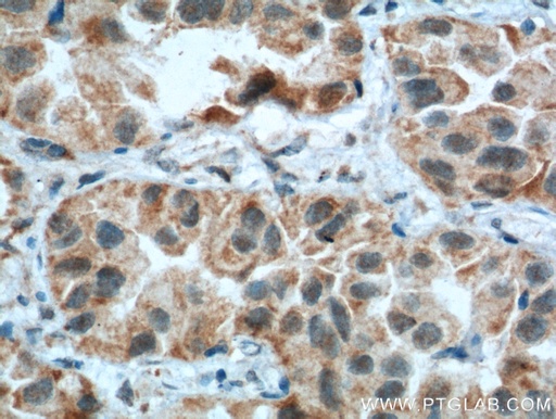 [55027-1-AP-20UL] CSPG4,NG2 Polyclonal antibody
