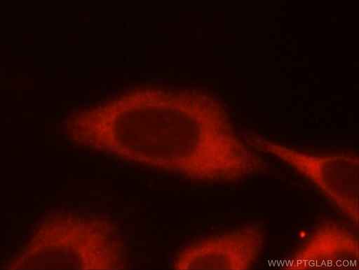 [55028-1-AP-150UL] PFKM Polyclonal antibody