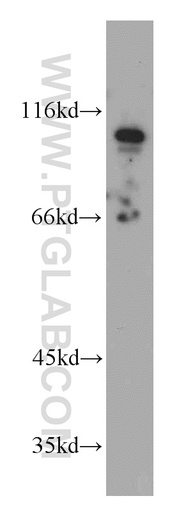 [55029-1-AP-150UL] ELF1 Polyclonal antibody