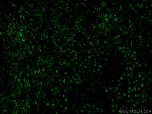 [55031-1-AP-20UL] CDC25A Polyclonal antibody