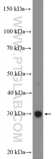 [55032-1-AP-150UL] EMX1 Polyclonal antibody