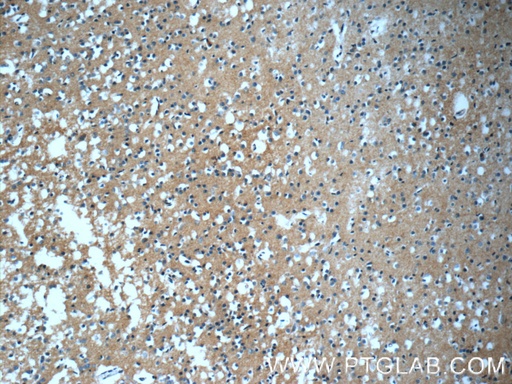 [55038-1-AP-150UL] GFRA2 Polyclonal antibody