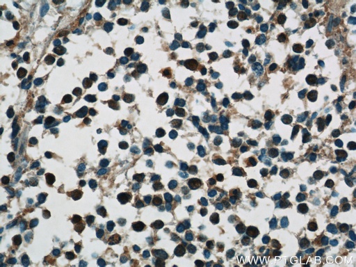 [55047-1-AP-150UL] HuC Polyclonal antibody