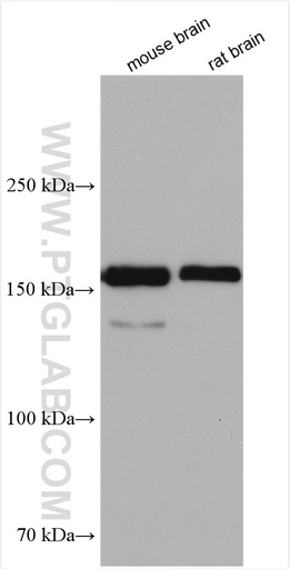 [55048-1-AP-150UL] MAGI1 Polyclonal antibody
