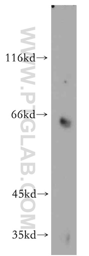 [55055-1-AP-150UL] Toca 1 Polyclonal antibody