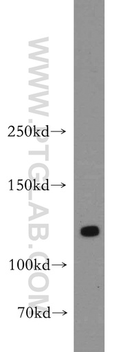 [55056-1-AP-150UL] DLGAP3 Polyclonal antibody