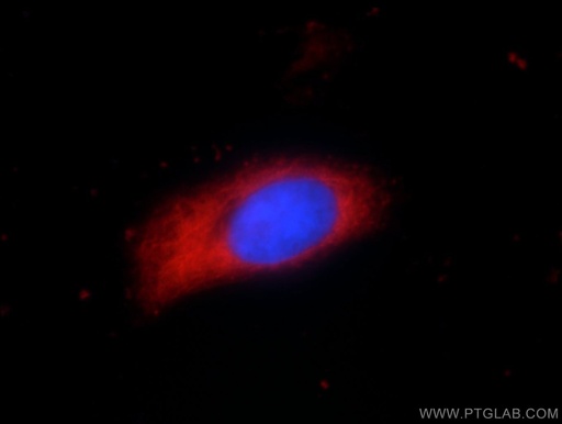 [55060-1-AP-20UL] PYCR2 Polyclonal antibody