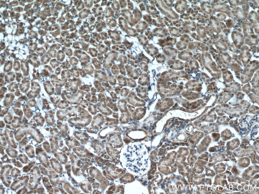 [55061-1-AP-150UL] XYLT1 Polyclonal antibody