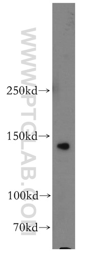 [55063-1-AP-20UL] SORCS2 Polyclonal antibody