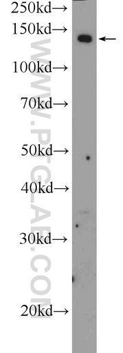 [55065-1-AP-150UL] ADCY8 Polyclonal antibody