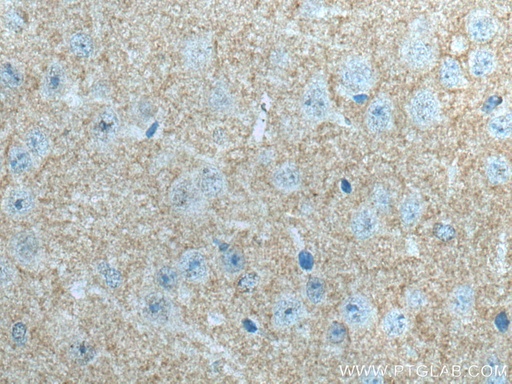 [55067-1-AP-150UL] ADCY1 Polyclonal antibody