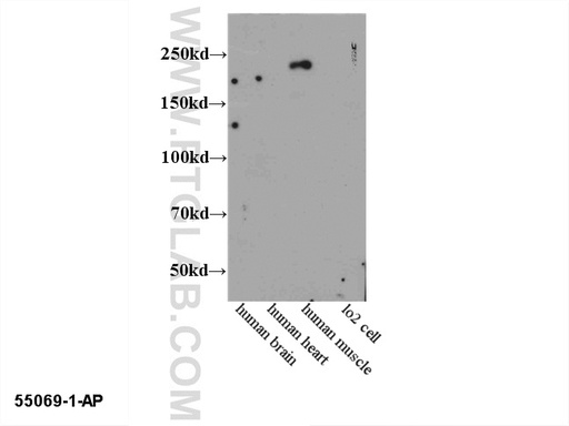 [55069-1-AP-150UL] MYH2-specific Polyclonal antibody