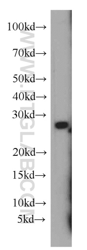 [55072-1-AP-20UL] HLA-DQA2 Polyclonal antibody