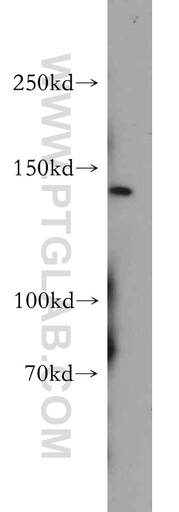 [55091-1-AP-150UL] PTCH2 Polyclonal antibody