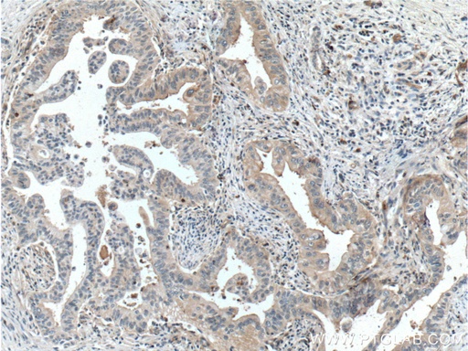 [55093-1-AP-150UL] Frizzled 8 Polyclonal antibody